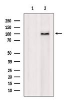 DPP9 Antibody in Western Blot (WB)