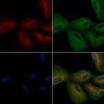 DRD2 Antibody in Immunocytochemistry (ICC/IF)