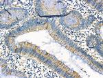 DRD2 Antibody in Immunohistochemistry (Paraffin) (IHC (P))