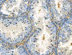 DRD2 Antibody in Immunohistochemistry (Paraffin) (IHC (P))