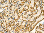 DRD2 Antibody in Immunohistochemistry (Paraffin) (IHC (P))