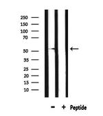 DRD2 Antibody in Western Blot (WB)