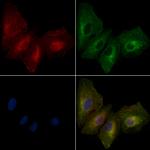 Desmoglein 3 Antibody in Immunocytochemistry (ICC/IF)