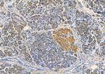 Desmoglein 3 Antibody in Immunohistochemistry (Paraffin) (IHC (P))