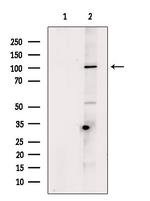 Desmoglein 3 Antibody in Western Blot (WB)