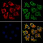 DTX4 Antibody in Immunocytochemistry (ICC/IF)