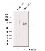 DTX4 Antibody in Western Blot (WB)