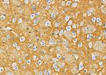 DYNC1H1 Antibody in Immunohistochemistry (Paraffin) (IHC (P))