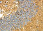 DYNC1H1 Antibody in Immunohistochemistry (Paraffin) (IHC (P))