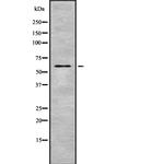 GLT-1 Antibody in Western Blot (WB)