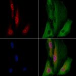 EBF2 Antibody in Immunocytochemistry (ICC/IF)