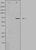 HRI Antibody in Western Blot (WB)