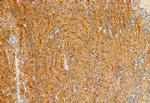 eIF4A3 Antibody in Immunohistochemistry (Paraffin) (IHC (P))