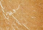 eIF4A3 Antibody in Immunohistochemistry (Paraffin) (IHC (P))