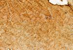 eIF4A3 Antibody in Immunohistochemistry (Paraffin) (IHC (P))