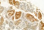 eIF4A3 Antibody in Immunohistochemistry (Paraffin) (IHC (P))