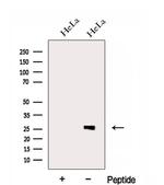 eIF4H Antibody in Western Blot (WB)