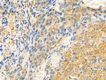 EphB2 Antibody in Immunohistochemistry (Paraffin) (IHC (P))