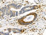 EphB4 Antibody in Immunohistochemistry (Paraffin) (IHC (P))