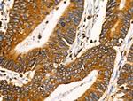 EphB4 Antibody in Immunohistochemistry (Paraffin) (IHC (P))