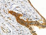 EphB4 Antibody in Immunohistochemistry (Paraffin) (IHC (P))