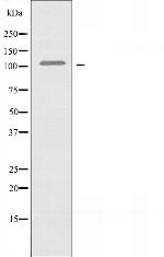 EphB4 Antibody in Western Blot (WB)