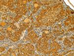 ERLIN2 Antibody in Immunohistochemistry (Paraffin) (IHC (P))