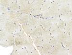 FARSB Antibody in Immunohistochemistry (Paraffin) (IHC (P))