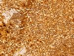 FARSB Antibody in Immunohistochemistry (Paraffin) (IHC (P))