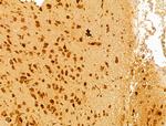 FARSB Antibody in Immunohistochemistry (Paraffin) (IHC (P))