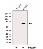 FARSB Antibody in Western Blot (WB)