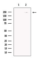 Myosin Heavy Chain Antibody in Western Blot (WB)