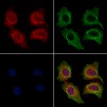 FCER1G Antibody in Immunocytochemistry (ICC/IF)