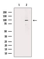 Fibrinogen Antibody in Western Blot (WB)