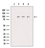 FGFR1/FGFR2 Antibody in Western Blot (WB)