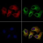 Filamin B Antibody in Immunocytochemistry (ICC/IF)