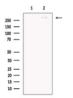 Filamin B Antibody in Western Blot (WB)