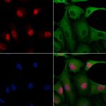 FKBP3 Antibody in Immunocytochemistry (ICC/IF)