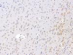 FKBP3 Antibody in Immunohistochemistry (Paraffin) (IHC (P))