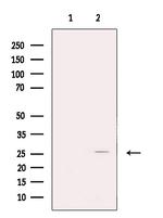 FKBP3 Antibody in Western Blot (WB)