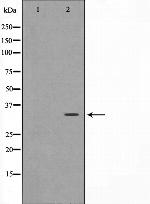 FosB Antibody in Western Blot (WB)