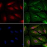 FOXA1 Antibody in Immunocytochemistry (ICC/IF)