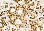 FOXA1 Antibody in Immunohistochemistry (Paraffin) (IHC (P))