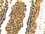 Fra1 Antibody in Immunohistochemistry (Paraffin) (IHC (P))