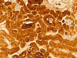 FTCD Antibody in Immunohistochemistry (Paraffin) (IHC (P))