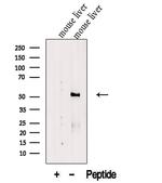 FTCD Antibody in Western Blot (WB)