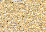 FZD1 Antibody in Immunohistochemistry (Paraffin) (IHC (P))