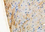 FZD9 Antibody in Immunohistochemistry (Paraffin) (IHC (P))