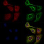 GABRB3 Antibody in Immunocytochemistry (ICC/IF)