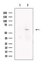 GABRB3 Antibody in Western Blot (WB)